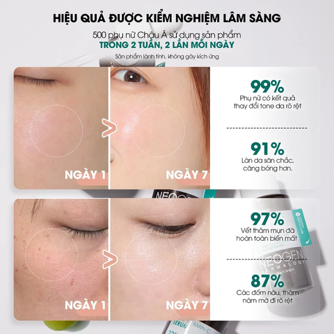 Serum Dưỡng Trắng Mờ Thâm 460x Vitamin C Sinh Học Kakadu 22% Neogen Dermalogy 32g