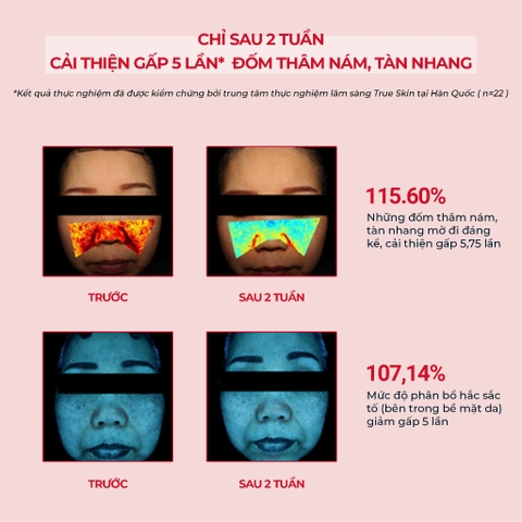 Kem Dưỡng Giảm Thâm Nám Chuyên Biệt Angel's Liquid Tranexamic Mela Zero Cream 50ml