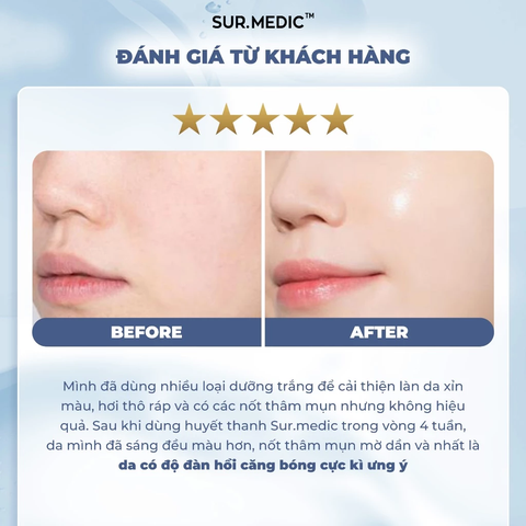 Huyết Thanh Dưỡng Trắng SUR.MEDIC+ Super Glutathione Bright Ampoule 32ml