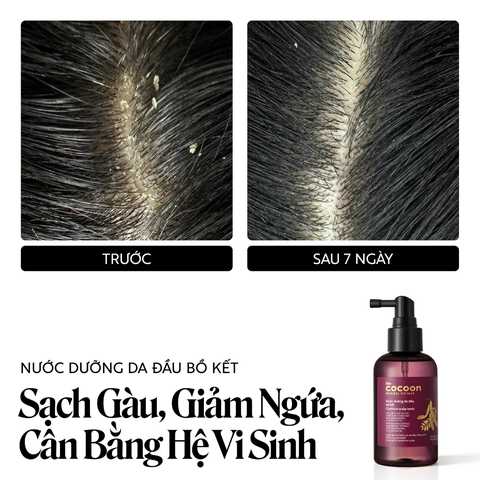 Nước Dưỡng Tóc Cocoon Bồ Kết Giảm Gàu Cho Da Đầu Nhạy Cảm 140ml