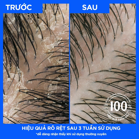 Dầu Gội Và Xả 2in1 Sạch Gàu Head&Shoulders Mỹ Sạch Sâu 370ml