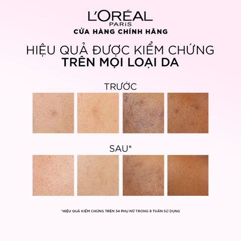 Tinh Chất Tẩy Tế Bào Chết L'Oreal Paris Glycolic Bright Anti Dark Spot Exfoliant Peel 25ml