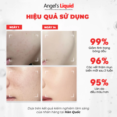 Serum Làm Trắng, Kiểm Soát Dầu, Nhỏ Lỗ Chân Lông Angel's Liquid Glutathione +10% Niacinamide Cica Ampoule 45ml