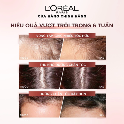 Xịt Serum Ngăn Ngừa & Giảm Gãy Rụng Tóc Giúp Tóc Chắc Khỏe L'Oreal Paris Full Resist Anti Hairfall 90ml