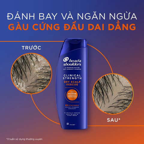 Dầu Gội Head&Shoulders Đặc Trị Chuyên Sâu Dành Cho Tóc Gãy Rụng 400ml