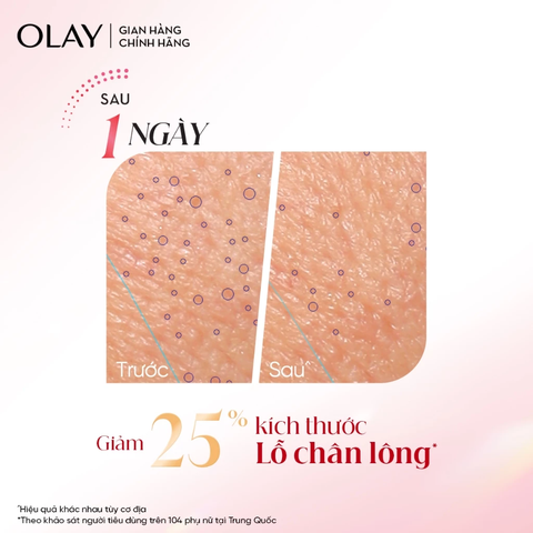 Kem Dưỡng Ẩm Olay Super Collagen Peptides Giúp Cải Thiện 5 Dấu Hiệu Lão Hóa Phức Tạp 45g
