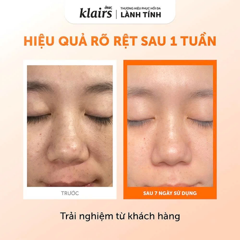 Nước Hoa Hồng Dear Klairs Freshly Juiced Vitamin Essence Toner Hỗ Trợ Sáng Da 180ml
