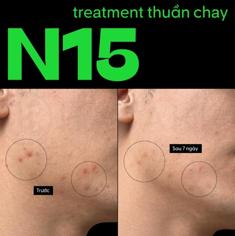 Serum Cocoon Bí Đao N15 Giảm Bóng Nhờn Và Giảm Mụn 70ml