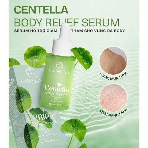 Serum Giảm Mụn Xóa Thâm Body Centella Relief Serum Carolina 30ml - Xóa mụn thâm sần cơ thể