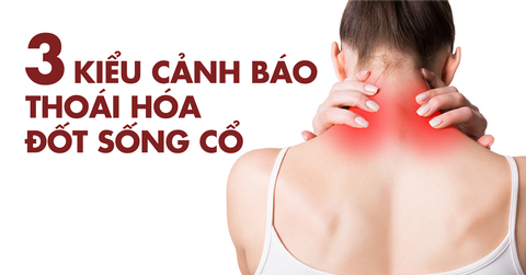 NHẬN BIẾT SỚM 3 KIỂU ĐAU CỔ VAI GÁY BÁO HIỆU THOÁI HÓA ĐỐT SỐNG CỔ