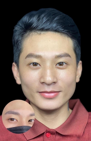 Fixing Botched Eyebrows - Sửa Chân Mày Hư (Nam)