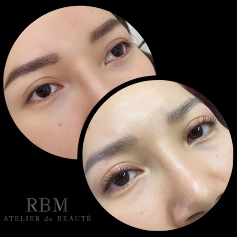 Uốn Phủ Mi Collagen