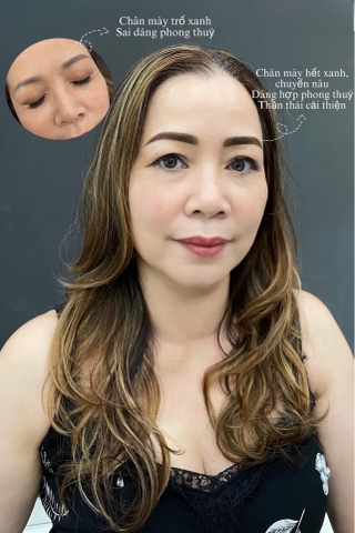 Fixing Botched Eyebrows - Sửa Chân Mày Hư (Nữ)
