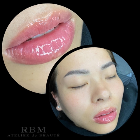 Removing Dark Lips - Khử Thâm Môi (Nữ)
