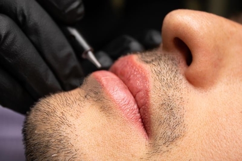 Removing Dark Lips - Khử Thâm Môi (Nam)