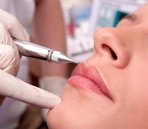 Removing Botched Lips By Liquid - Hút Dung Dịch Môi