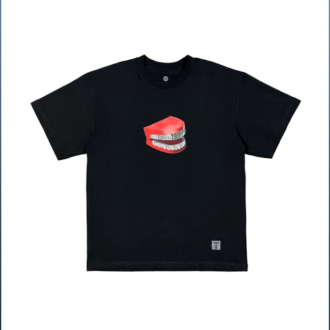 Chatter Teeth