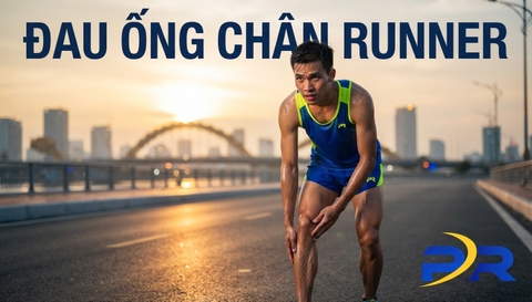 CẢNH BÁO Y HỌC ĐƯỜNG CHẠY: HỘI CHỨNG ĐAU ỐNG CHÂN (SHIN SPLINTS) VÀ NGUY CƠ RẠN XƯƠNG DÀNH CHO RUNNER MỚI