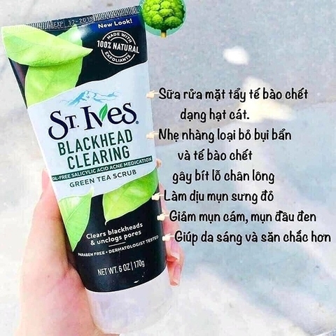 Sữa Rửa Mặt St.Ives 170g