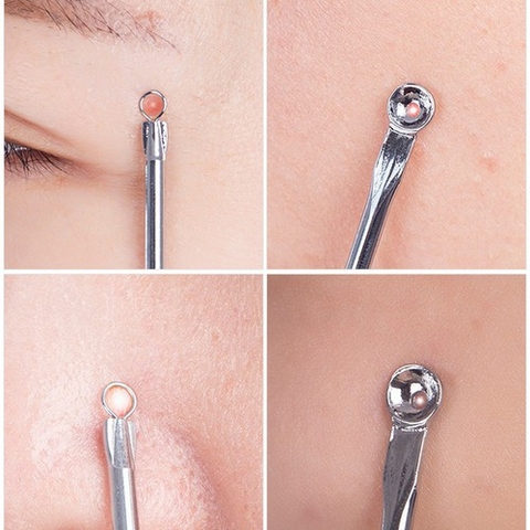 17.3 Dụng cụ nặn mụn hai đầu SEIWA PRO