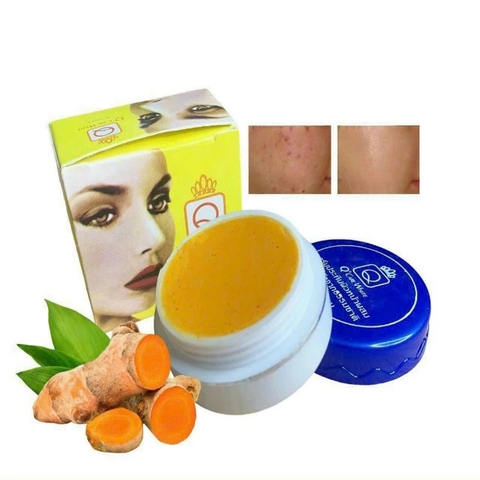 Kem Nghệ Trị Mụn, Thâm Sẹo Q'Care White 5g