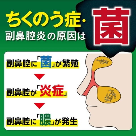 Kobayashi Chikunain - Xịt Xoang Mũi (30ml)