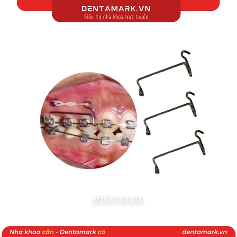 Khí cụ di xa răng (Chiếc)