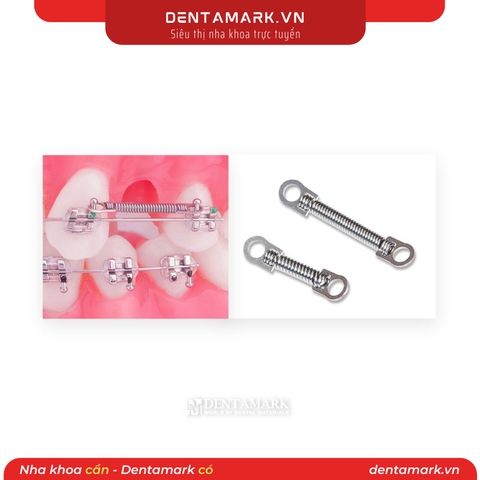 Lò xo kéo nha khoa đóng khoảng Đầu nhỏ (Gói 10 cái)