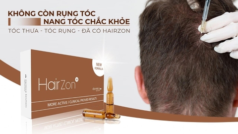 TIÊM MESOTHERAPY HAIRZON GIÚP KÍCH THÍCH MỌC TÓC, ĐIỀU TRỊ CHỨNG RỤNG TÓC VÀ MỌC THƯA