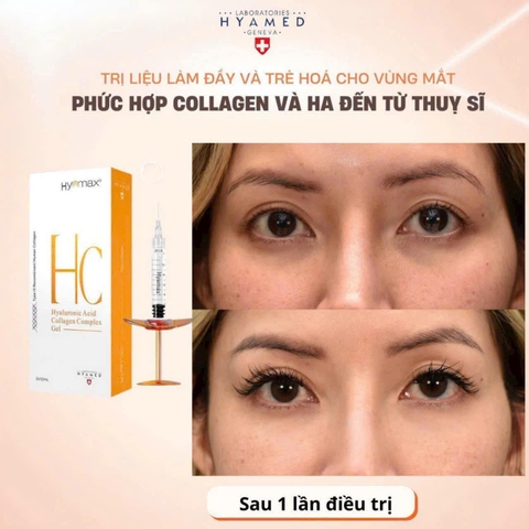 HYAMAX HC HYALURONIC ACID COLLAGEN COMPLEX GEL / CHẤT LÀM ĐẦY VÀ TRẺ HÓA VÙNG MẮT