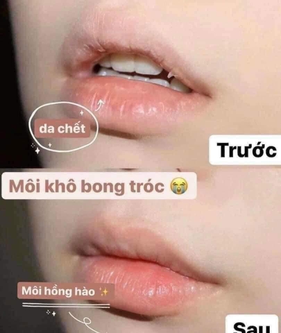 Son Dưỡng Môi Không Màu Bioderma Atoderm Levres Stick Hydratant