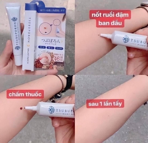 Serum trị mụn thịt mụn ruồi Tsubuporon Nhật Bản