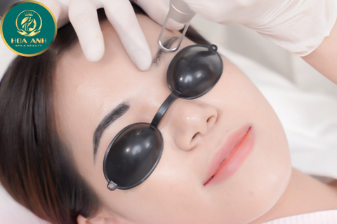 KHÓA HỌC XÓA MÔI MÀY MÍ BẰNG CÔNG NGHỆ LASER – GIẢI PHÁP HIỆU QUẢ TRONG LÀM ĐẸP