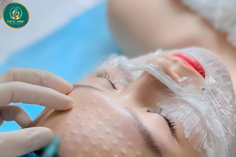 Khóa Học Cấy Meso