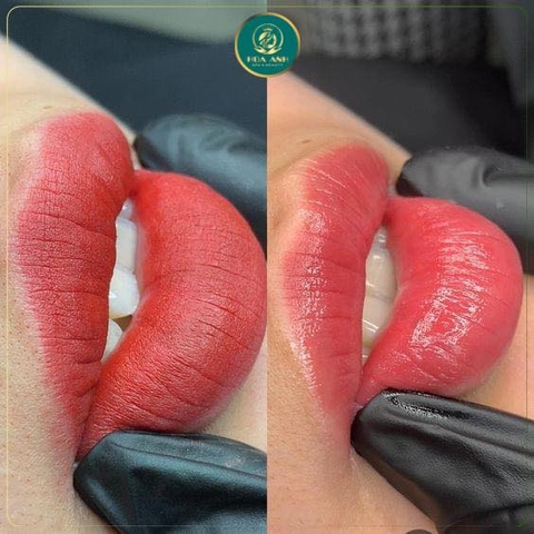 CHĂM SÓC MÔI TẠI NHÀ SAU KHI PHUN- PHUN MÔI NÊN VÀ KHÔNG NÊN ĂN NHỮNG GÌ