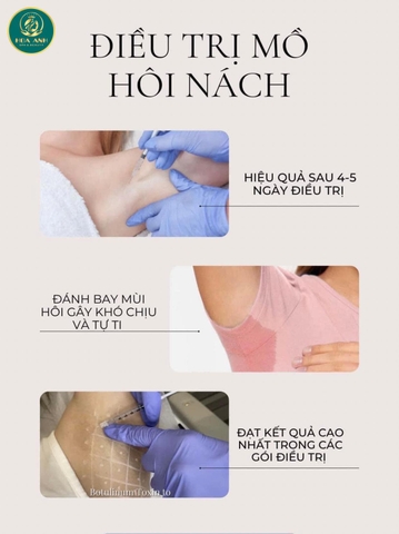 TIÊM BOTOX TRỊ HÔI NÁCH CÓ HIỆU QUẢ KHÔNG ? GIÁ TIÊM BOTOX TRỊ HÔI NÁCH