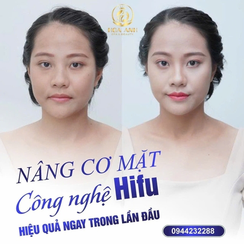 KHÓA HỌC MÁY ĐIỀU TRỊ NÂNG CƠ HIFU