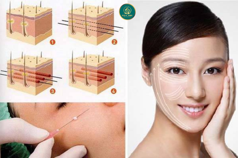 Khóa Học Nâng Cơ Mặt Bằng Chỉ - Bí Quyết Trẻ Hóa Làn Da Không Xâm Lấn