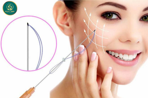 KHÓA ĐÀO TẠO CĂNG DA VÀ NÂNG CƠ BẰNG CHỈ