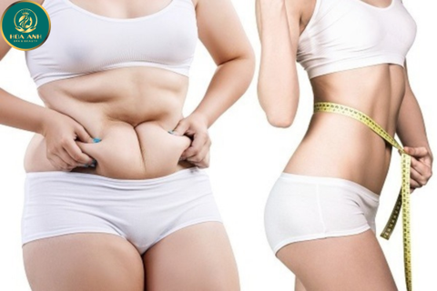 KHÓA HỌC GIẢM BÉO BẰNG CÔNG NGHỆ LIPO ZERO - GIẢI PHÁP TỐI ƯU CHO SỨC KHỎE VÀ SẮC ĐẸP