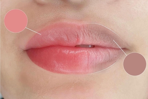 KHỬ THÂM MÔI LÀ GÌ ? NGUYÊN NHÂN DẪN ĐẾN TÌNH TRẠNG THÂM MÔI