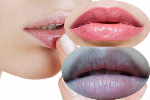 KHỬ THÂM MÔI VÀ PHUN MÔI KHÁC NHAU NHƯ THẾ NÀO ? NÊN CHỌN KHỬ THÂM MÔI HAY PHUN MÔI