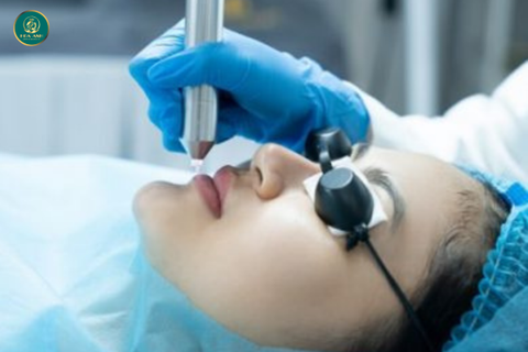 KHÓA HỌC KHỬ THÂM MÔI BẰNG LASER – ĐẲNG CẤP CHUYÊN NGHIỆP, NÂNG TẦM NGHỀ LÀM ĐẸP