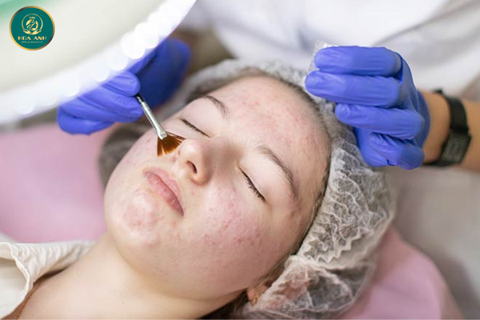 KHÓA HỌC LẤY MỤN