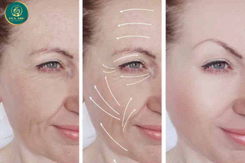 Khóa Học Nâng Cơ Vùng Mặt Chuyên Sâu – Bứt Phá Tay Nghề, Gia Tăng Thu Nhập Ngành Thẩm Mỹ