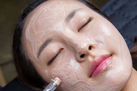 CẤY TRẮNG DA MẶT CÓ TỐT KHÔNG ? CÓ AN TOÀN ĐỂ THỰC HIỆN KHÔNG ?