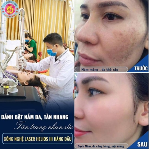 KHÓA ĐÀO TẠO CHUYÊN VỀ CÁC DÒNG MÁY LASER TRONG THẨM MỸ - CAM KẾT RA NGHỀ
