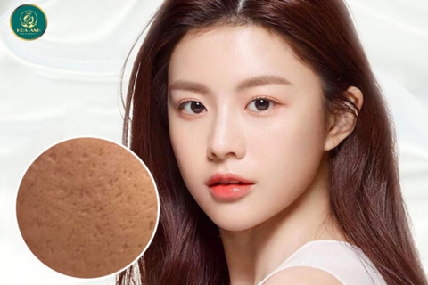 Khóa Học Điều Trị Sẹo Rỗ - Giải Pháp Hiệu Quả Cho Làn Da