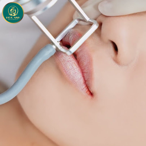 Khóa Học Chuyên Sâu Về Khử Thâm Môi Bằng Công Nghệ Laser – Cơ Hội Nâng Tầm Sự Nghiệp Spa