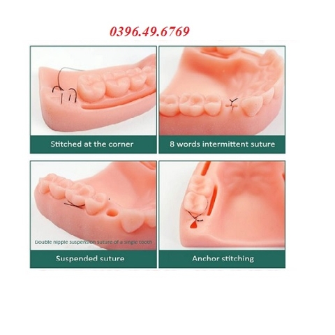 MÔ HÌNH THỰC HÀNH KHÂU NƯỚU LỢI NHA KHOA